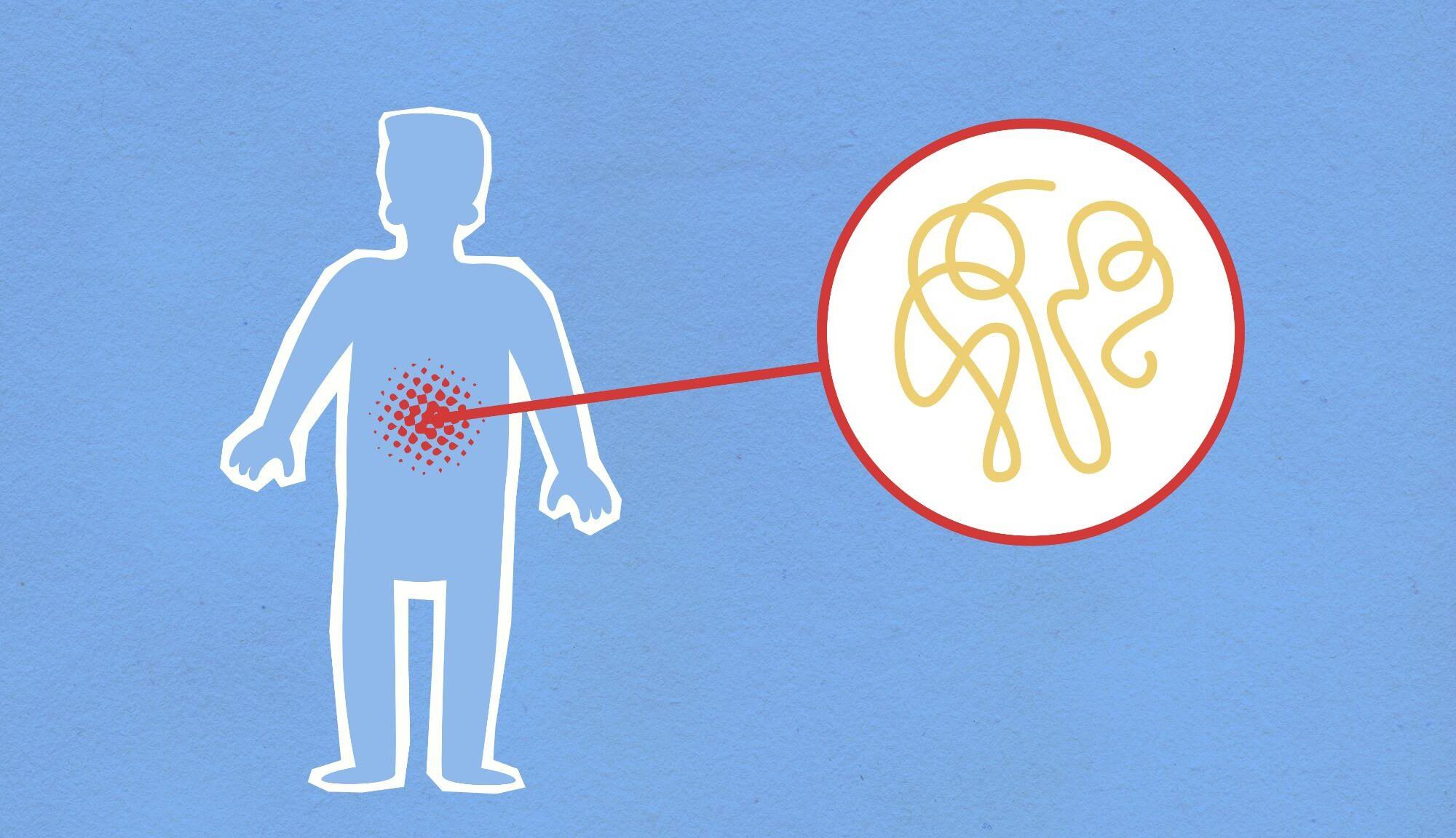 inflammation, chronic inflammation, reduce inflammation, healthy habits, wellness tips